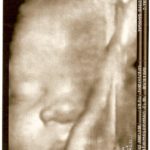 jed scan 34 weeks