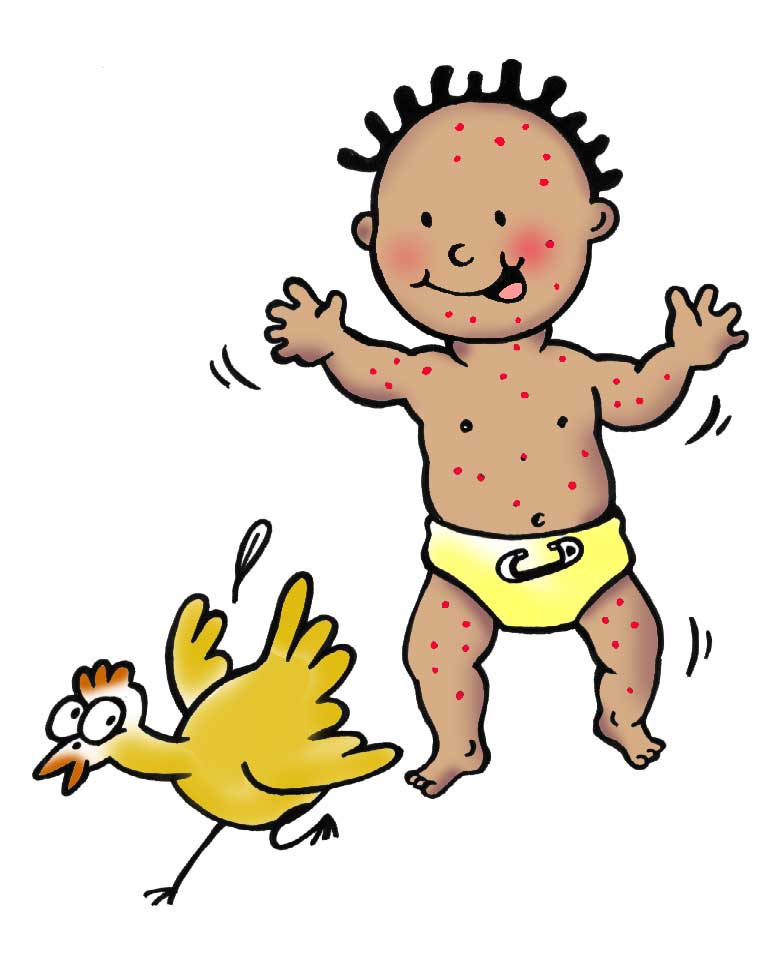 clipart chicken pox - photo #5